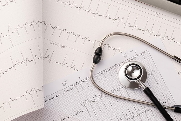 健康診断のイメージ写真